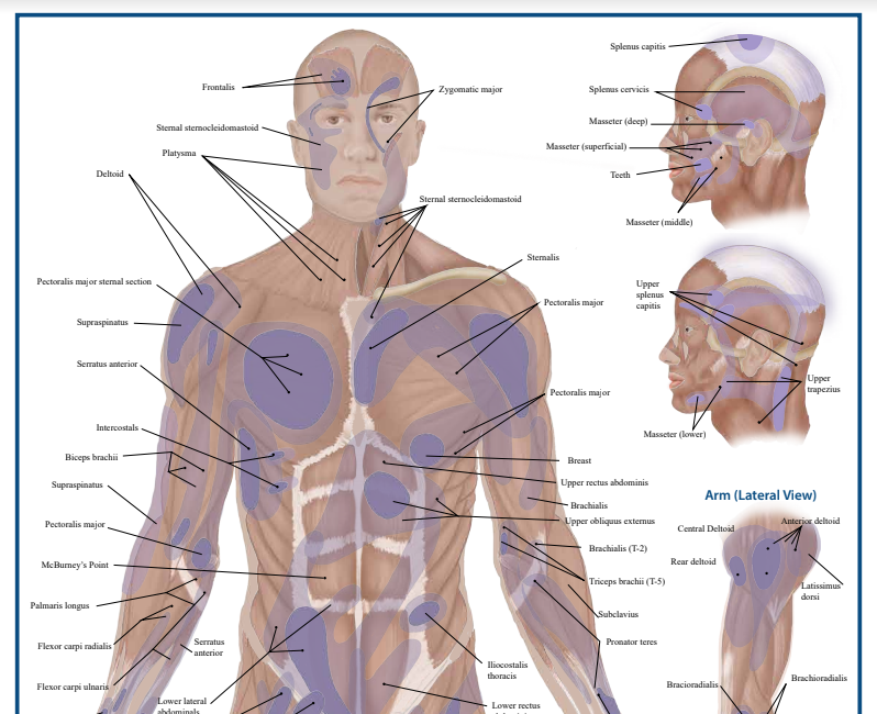 Two Trigger Point Anatomy Maps - Medical Office Wall Poster for Reference by Massage Therapists, Physical Therapists, Chiropractors, Trainers - Pressure Point and Referred Pain Chart (Poster sized) Pack of 2